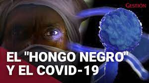 Detectan caso de hongo negro en edomex; El Hongo Negro Y Covid 19 Lo Que Debes Saber Sobre Esta Peligrosa Enfermedad Youtube
