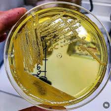 Image result for Staphylococcus Saprophyticus