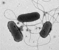 To diagnose illness caused by e. Know Your Enemy Escherichia Coli E Coli Global Food Safety Resource
