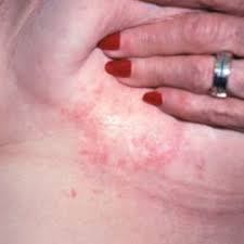 Pin On Women Health