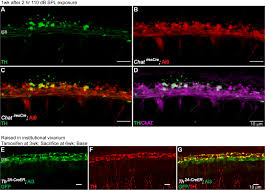 Obc full form in hindi. Sound Exposure Dynamically Induces Dopamine Synthesis In Cholinergic Loc Efferents For Feedback To Auditory Nerve Fibers Elife