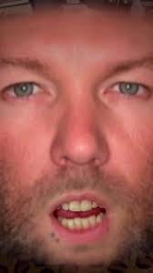 Fred Durst Saying Yeah