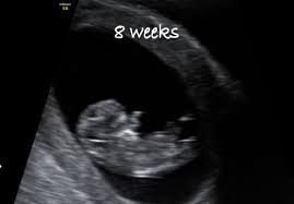 By 6 to 7 weeks gestation the fetus feedback clearly seen. Early Pregnancy Scans For Dating The Baby Scan Studio Facebook