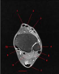Mri Of The Ankle Detailed Anatomy W Radiology