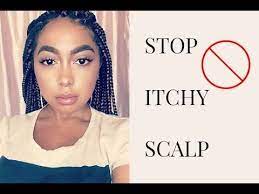 How To Stop Itchy Scalp Causes Box Braid Series Pt 2 Youtube Scalp Braids Itchy Scalp Remedy Hair Beauty