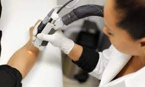 How does cynosure laser hair removal work? Top 6 Laser Hair Removal Laser Hair Removal Guide Facebook