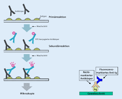 Antinukleare Antikorper In Der Diagnostik Rheumatischer Erkrankungen Springerlink