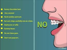 Things To Avoid When Wearing Braces Braces Tips Getting Braces Braces Colors