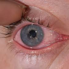 Image result for Cornea
