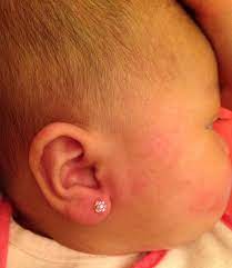 4 Months Old Wearing Blomdahl Medical Grade Plastic Earrings Piercing By Rachel Smith Rn Ear Jacket Earring Baby Ear Piercing Piercing Stud Earrings