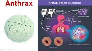 Image result for Anthrax