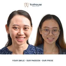 ✨ Meet Dr. Darryl Lim ✨ We are excited to welcome the newest member of our  team here at Toothouse! 🦷 With a passion for creating beautiful smiles and  years of experience