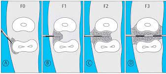 Pin By Rezaan Almg On Dental Studies Diagnosis Disease Dental