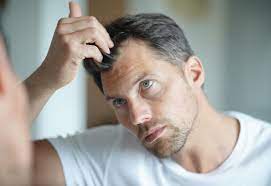 Cigarette smoke contains almost 4,000 lethal and damaging chemicals that can cause normal hair loss. Can Smoking Cause Hair Loss Nioxin