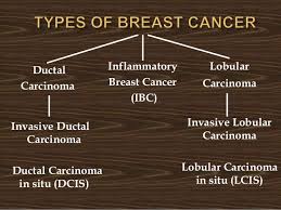 1) intravenous chemotherapy :the most common way involves inserting a small needle and plastic tube called a cannula into a vein, either in the back of the hand or lower arm. Breast Cancer