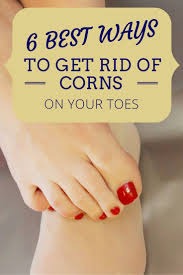 Corns Are Common Skin Conditions That Often Develop When A Particular Area Of Yo Cornsontoes Corn On Toe Get Rid Of Corns Corn Treatment