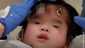 無眼天使！8歲盲童唱歌戰勝開刀恐懼網淚讚：堅強的孩子| 國際| 三立新聞網SETN.COM