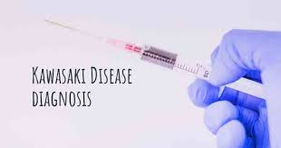 Image result for kawasaki disease diagnosis image