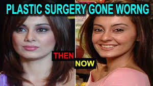 Manisha Lamba Looks Horrible Plastic Surgery Gone Worng À¤¨à¤¹ À¤® À¤² À¤°à¤¹ À¤¹ À¤« À¤² À¤® Youtube 34b, date de naissance, couleur des cheveux, couleur des yeux, nationalité. manisha lamba looks horrible plastic surgery gone worng à¤¨à¤¹ à¤® à¤² à¤°à¤¹ à¤¹ à¤« à¤² à¤®