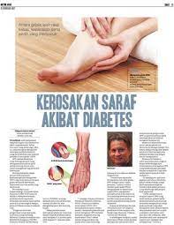 Bagaimanapun untuk pembelian terus ini, pembelian minimum ialah 2 botol ubat kencing manis ini. Kerosakan Saraf Akibat Diabetes Klik