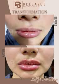 Profile for Bellavue Aesthetic Clinic