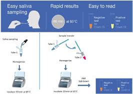 Am tag 5 bis 7 nach exposition. Promising Initial Results For A Covid 19 Diagnostic Test In Saliva Cnrs