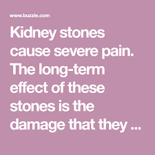 Pin On Kidney Stone