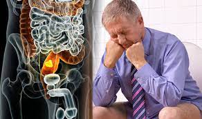 These conditions are far more common but can mimic many of the signs and symptoms of colon cancer. Colon Cancer Symptoms Four Signs To Check If You Go To The Bathroom Health Life And Style