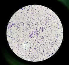 Image result for Staphylococcus Saprophyticus