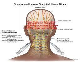 For some time now i have experienced pain at the base of my skull. Pin On Migraines Diseases Pains In The Etc