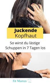 tipps gegen juckende kopfhaut juckende kopfhaut trockene haare hausmittel hausmittel gegen schuppen