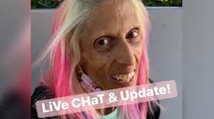 Rachael's Recovery Update and LiVe ChaT.. 💇‍♀️🌈🦄🎨