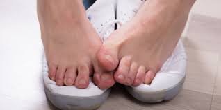 Many people have had success getting rid of nail fungus by treating it with hydrogen peroxide. Nail Fungus Treatment Faq Yes Let S Go There The Temple Skincare Spa