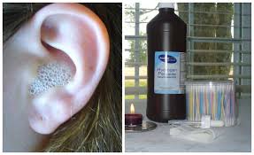 13 Hydrogen Peroxide Hacks You Never Knew About Clean Ear Wax Out Ear Cleaning Wax Ear Wax Buildup