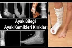 Fizyoo Fizik Tedavi Ve Rehabilitasyon Fizik Fizyoterapi Okuma