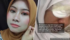 Mata berair tak hanya mengganggu kenyamanan tapi juga merusak penampilan. Mata Pedih Kabur Dan Kedai Cermin Mata Pokok Sena Facebook