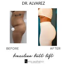 At mia aesthetics, we give our patients many different payment options . Mia Aesthetics Bbl By Dr Alvarez Facebook