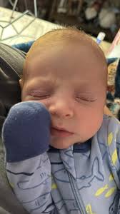 Is baby chin peeling and new skin normal?