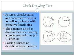 Supplementing a clock copy to the standard moca test (takes <1 min) will improve dementia assessment. Moca Scoring Nuances With Clock Draw Well She Gave It A Shot Funny