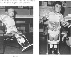 Image result for Parapodium