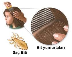 Bitten Kurtulmak Icin 6 Dogal Yontem Sagliga Bir Adim