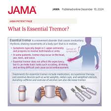 Image result for Essential Tremor