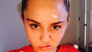 However, if people do choose to stop taking certain medications, jaber noted, their acne may return. How To Treat Hormonal Acne During Your Period Teen Vogue