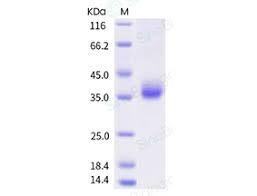 Burgdorf l 452 uploaded by franz scharner (2) lenco; Recombinant Sars Cov 2 Coronavirus Spike Protein Hek293 Cells His Tag 40592 V08h28 Sino Biological