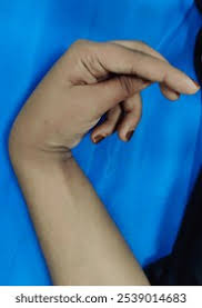 Image result for Tetany