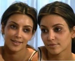 Her family's reality show, keeping up with the kardashians (kuwtk) has been on for more than a decade. Kim Kardashian Before Plastic Surgery Kimkardashian