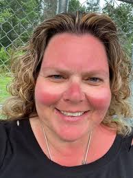 Sunburn relief after river float trip