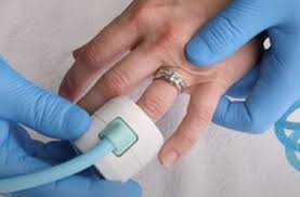 Image result for Ring Removal