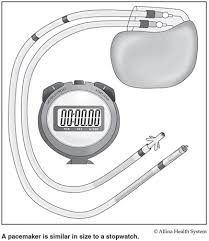A pacemaker is a small device that's placed under the skin of the chest or abdomen to help control abnormal heart rhythms. Pacemakers And Icd Helping Your Heart Allina Health