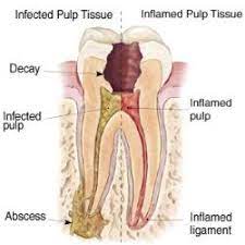 Pin On Home Remedies